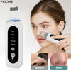 Ultrasonic Skin Blackhead Cleanser