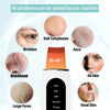 Ultrasonic Skin Blackhead Cleanser